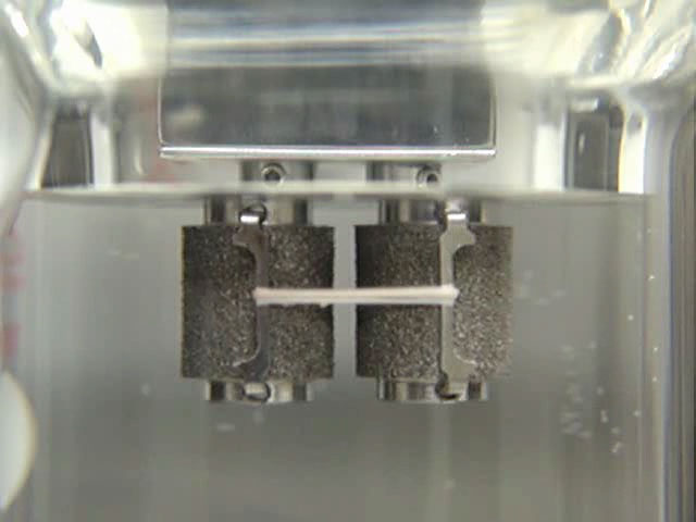 Subclavian Artery at 1s-1